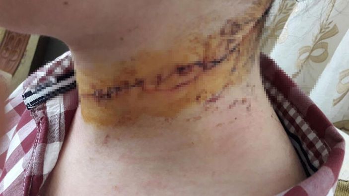 Kayseri'de eşinin boğazını kesen sanığa verilen ceza, yanlış hüküm gereği bozuldu