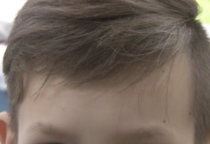 Rus saldırılarının ortasında kalan 13 yaşındaki çocuğun saçları beyazladı