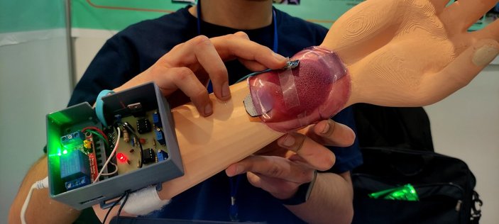 Bursa’da lise öğrencisi, yaraları iyileştiren cihaz geliştirdi