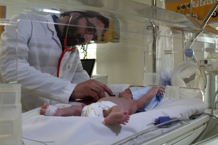 Tekirdağ’da 1.300 gram doğan Ayaz bebek, hayata tutundu
