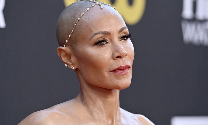 Will Smith'in eşi Jada Smith'in hastalığı: Alopesi nedir