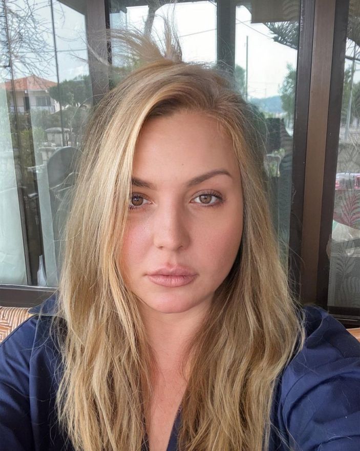 'Doktorum sağolsun' diyen Seda Akgül'ün makyajsız halini kimse tanıyamadı! 'Lolita olmuşsun'