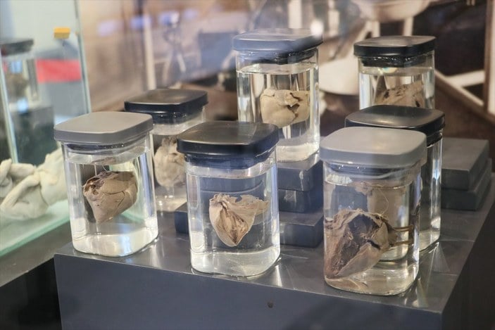 Samsun'da 30 yıllık bebek ve fetüsler, müzede sergilendi