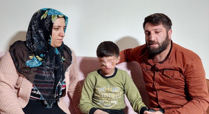 Erzurum'da cilt kanserinden gözleri kapanan Salih: Ailemi görmek istiyorum