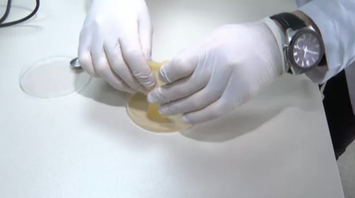 Boğaziçili öğrenciler, hastadan alınan numuneyle yapay deri üretti