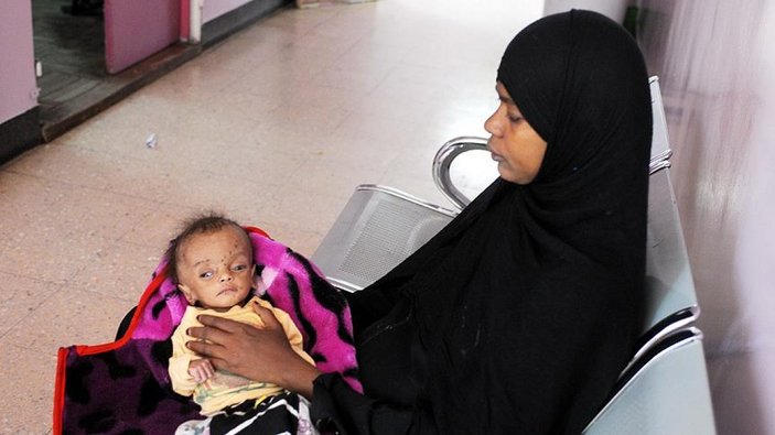 Yemenliler sıtma hastalığıyla boğuşuyor
