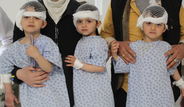 İşitme kaybı olan Suriyeli üçüzler, Gaziantep'te sağlıklarına kavuştu
