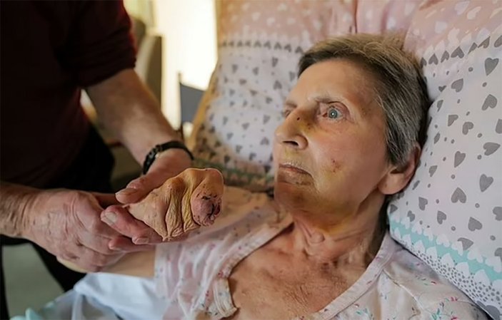 İngiltere'de yaşlı kadın, fare saldırısına uğradı