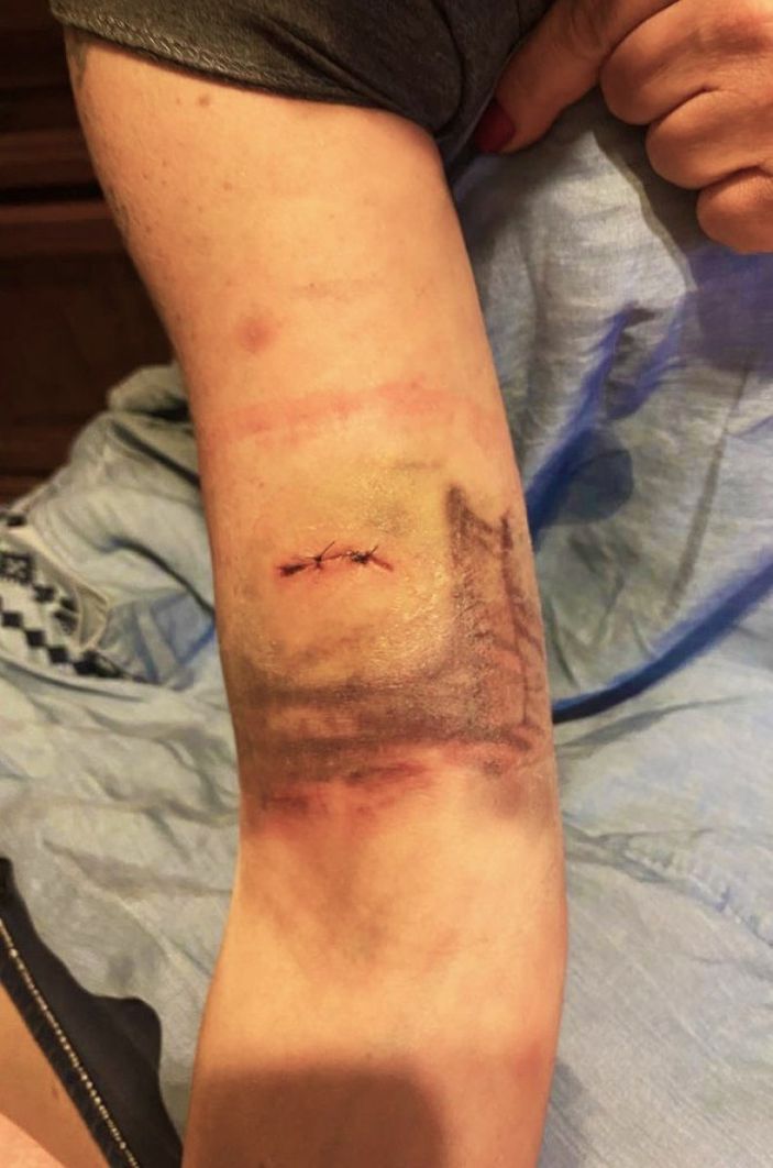 Ankara’da başıboş sokak köpekleri bir kadına saldırdı