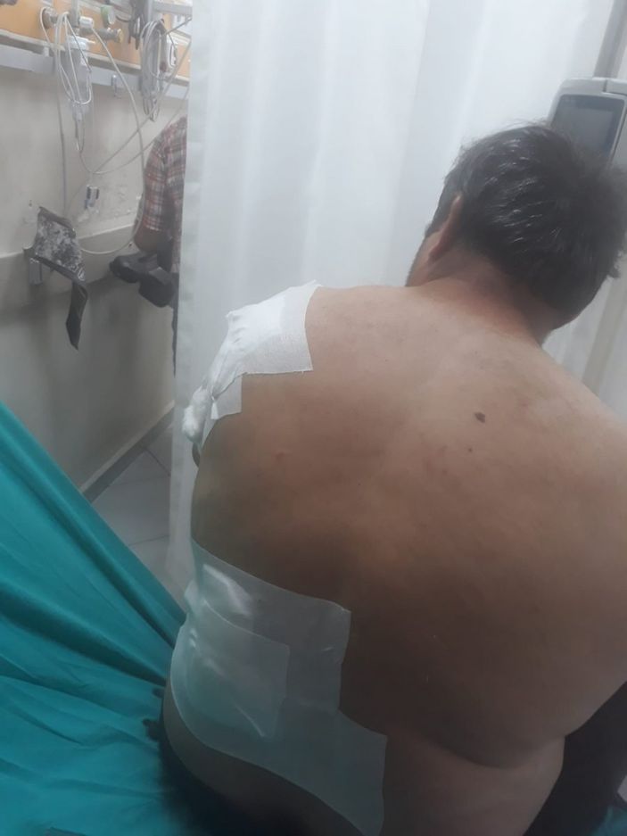 Bartın’da ayı saldırısı: Yerden yere vurdu