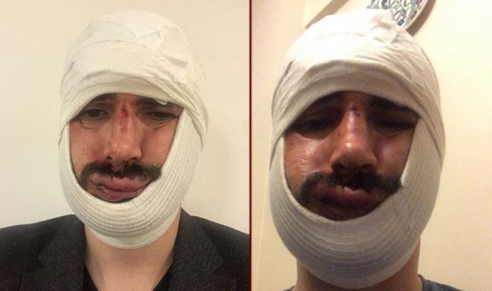 İstanbul'da basın mensubuna saldıran 2 sanığa 3’er yıl hapis