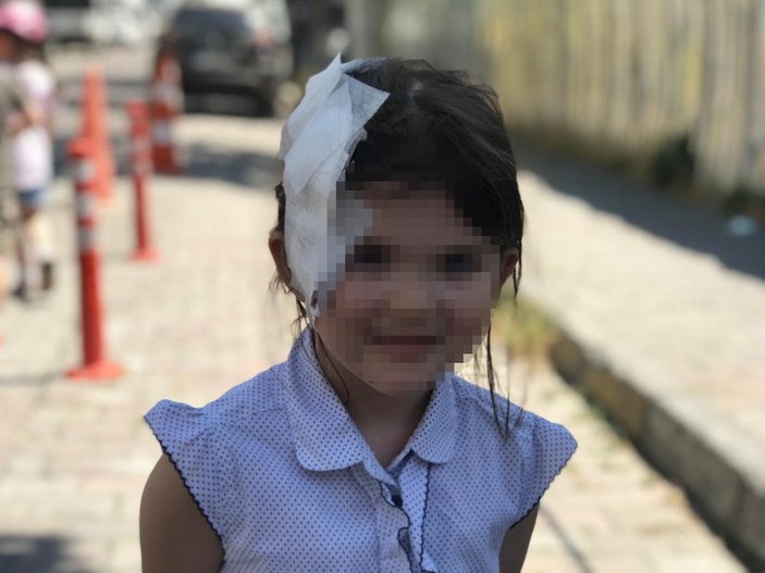 Gaziosmanpaşa’da kafesten çıkarılan pitbull kız çocuğuna saldırdı