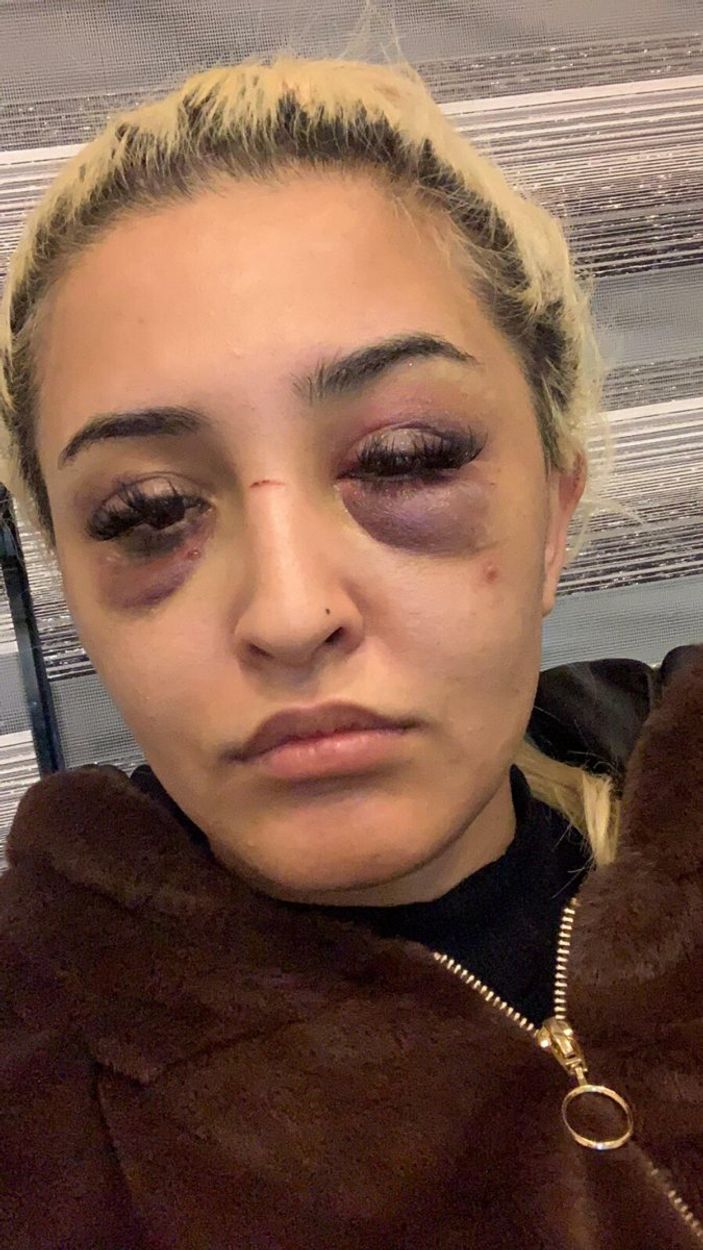 İzmir’de genç kadın, dayakçı sevgilisi ile barıştı