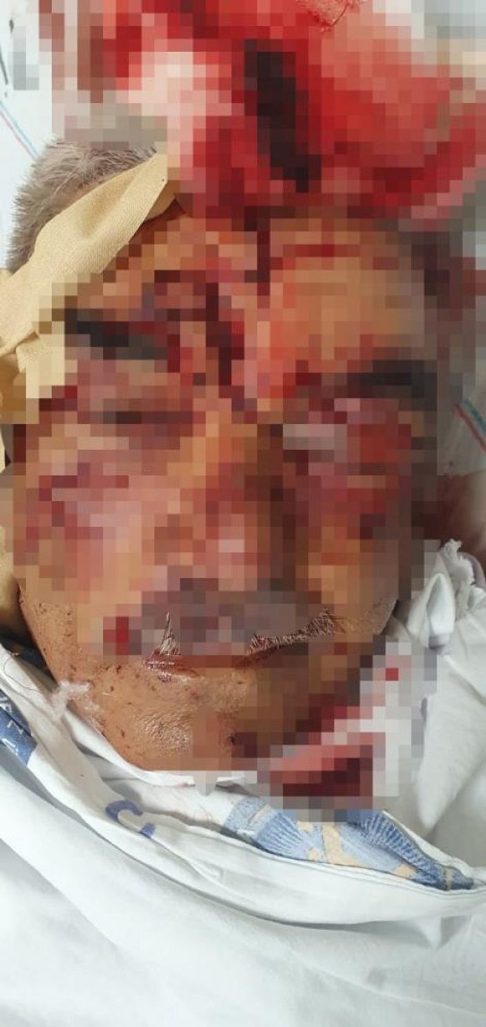 i Antalya'da komşusunun köpeği tarafından saldırıya uğradı