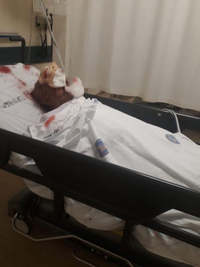 i Antalya'da komşusunun köpeği tarafından saldırıya uğradı