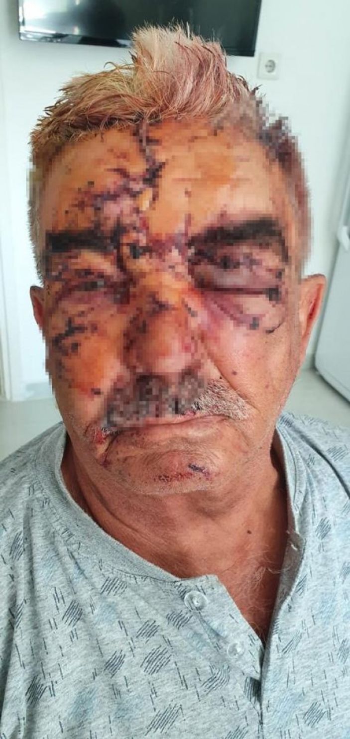 i Antalya'da komşusunun köpeği tarafından saldırıya uğradı