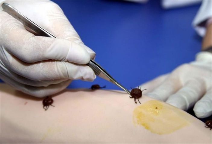 Sivas'ta KKKA tedavisi gören 2 kişi kurtarılamadı