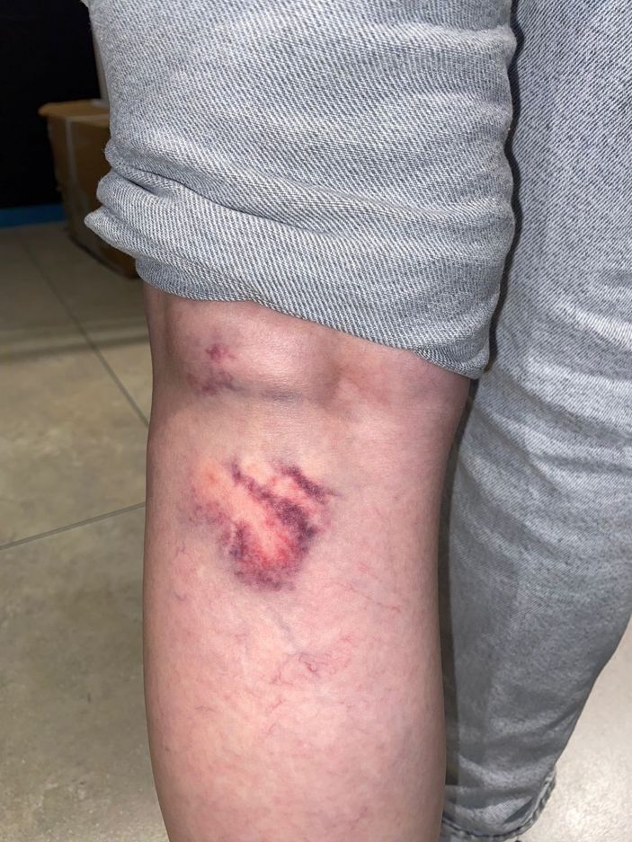 Zonguldak’ta genç kadına 15 sokak köpeğinin saldırdığı an