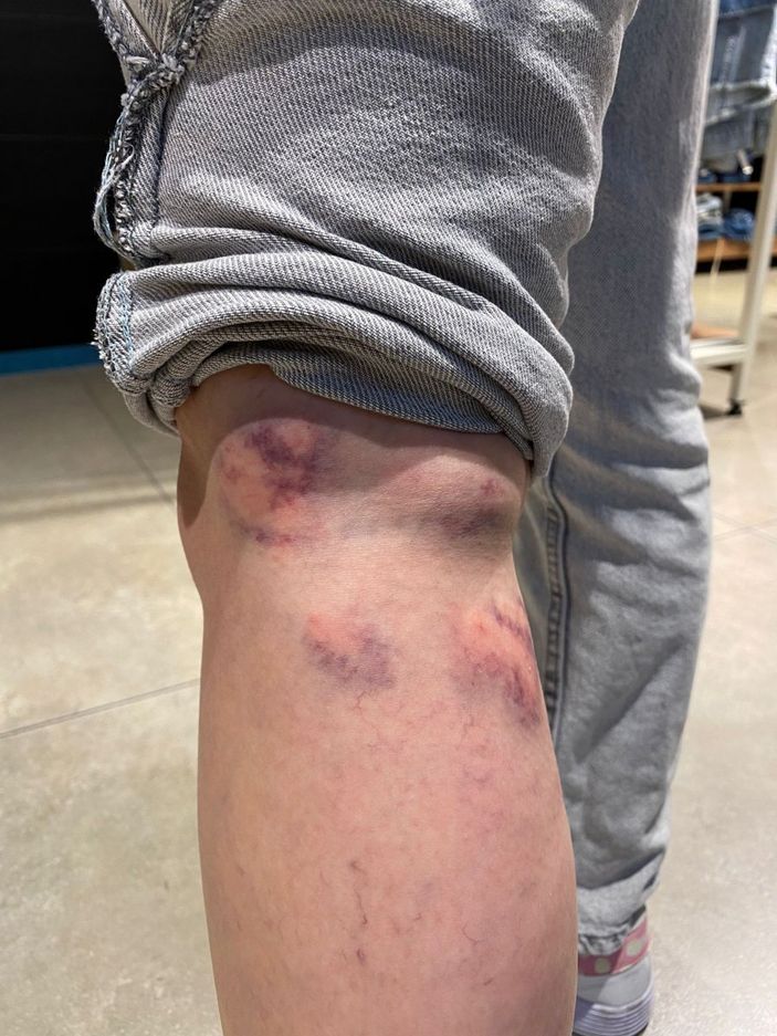 Zonguldak’ta genç kadına 15 sokak köpeğinin saldırdığı an