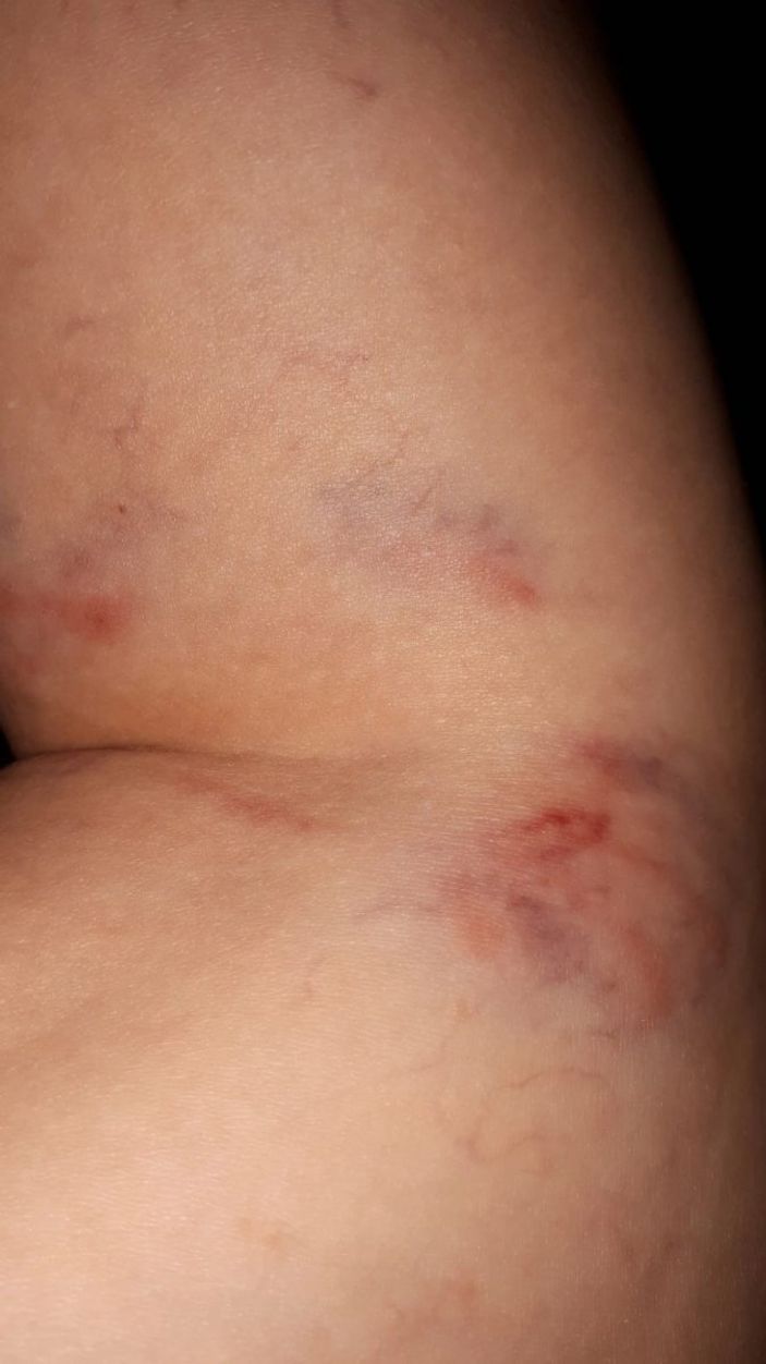 Zonguldak’ta genç kadına 15 sokak köpeğinin saldırdığı an