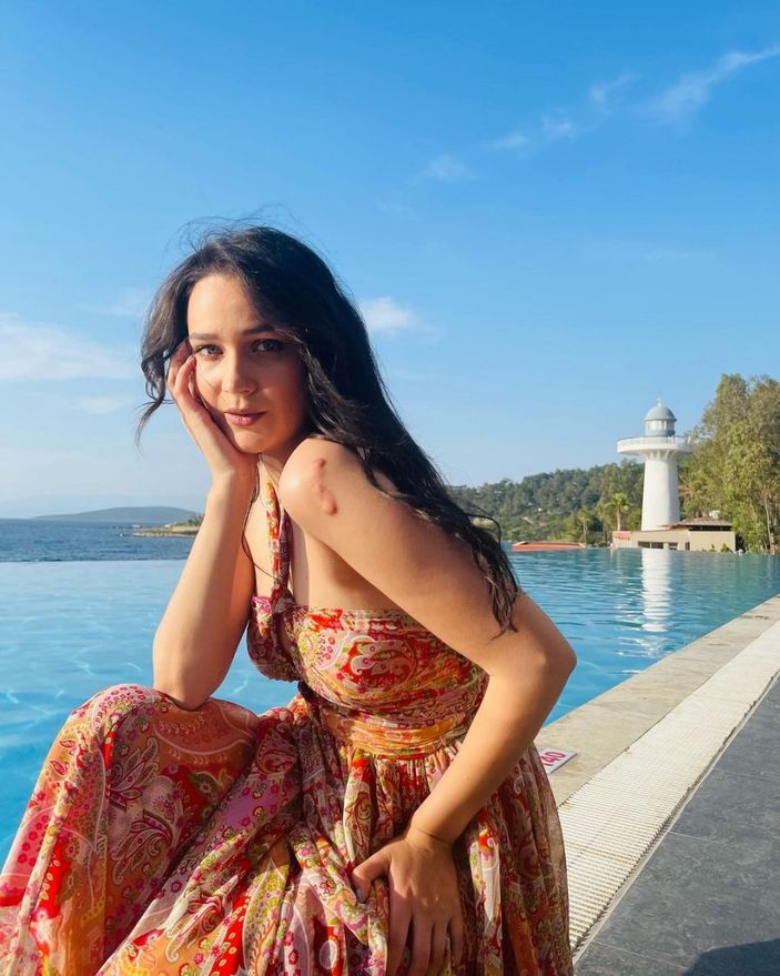 Gönül Dağı'nın Dilek'i havuz başında güneş banyosu yaptı, kolundaki iz dikkat çekti! 'Pürüzsüz tenine ne oldu'