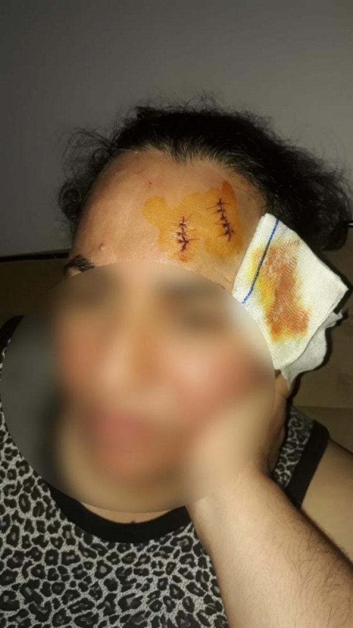 Adana'da komşusunu tencereyle yaralayan kadına hapis cezası