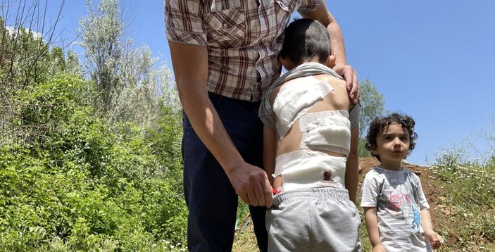Bingöl'de başıboş köpek dehşeti: 6 yaşındaki çocuğa saldırdılar