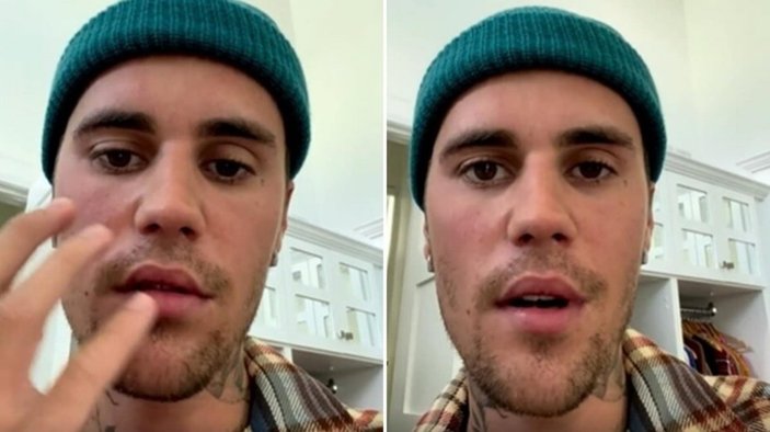 Justin Bieber, yüz felci hastalığıyla ilgili son durumunu paylaştı