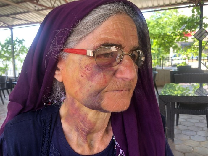 Adana'da kuzusu akrabasının sürüsüne karışınca darbedildi
