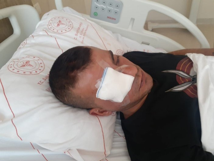 Antalya'da yüzde 40 engelli adamı öldüresiye dövüp gözünden ettiler