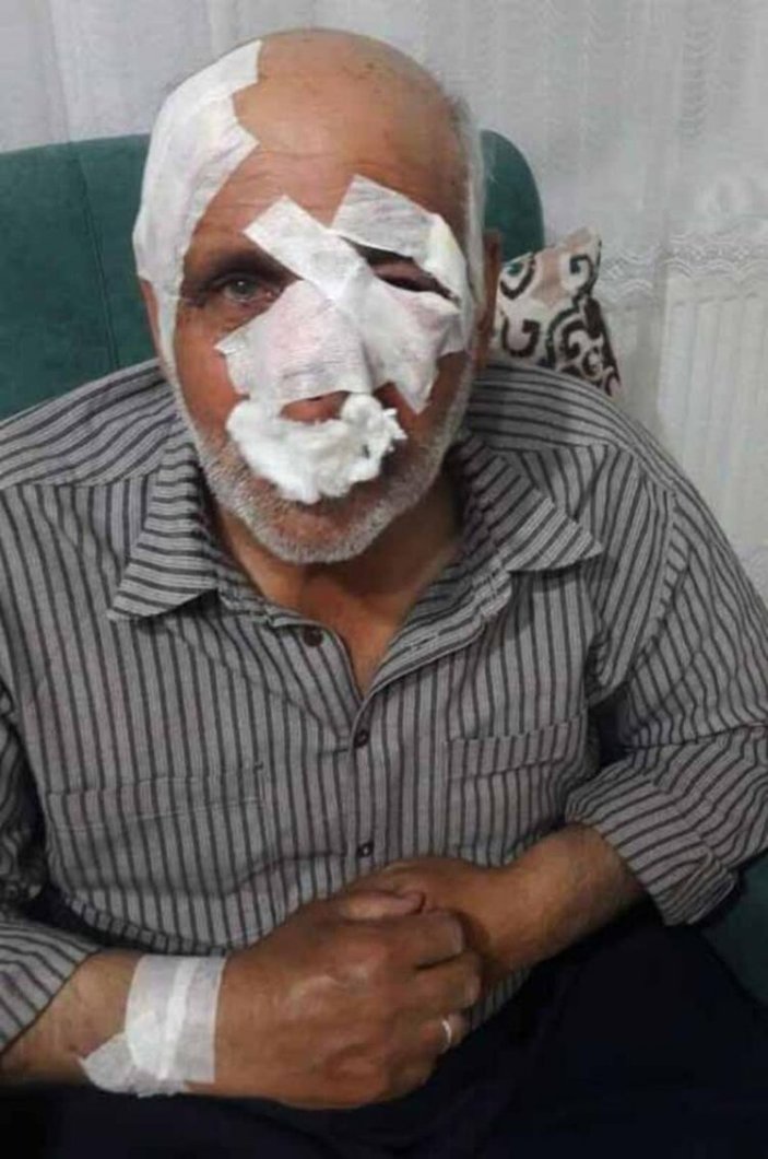 Gaziantep'te köpek saldırısına uğrayan yaşlı adam yoğun bakımda
