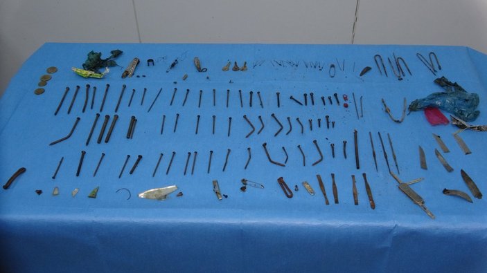 Van'daki hastanın midesinden çok sayıda kesici alet çıktı