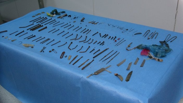 Van'daki hastanın midesinden çok sayıda kesici alet çıktı