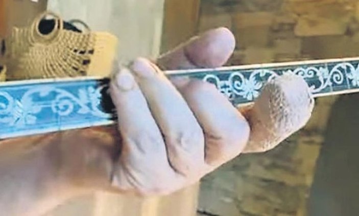 Orhan Gencebay'ın parmağına 11 dikiş atıldı
