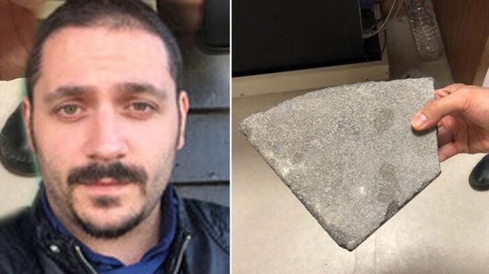 Şanlıurfa'daki doktora taşla saldıran şahıs tutuklandı