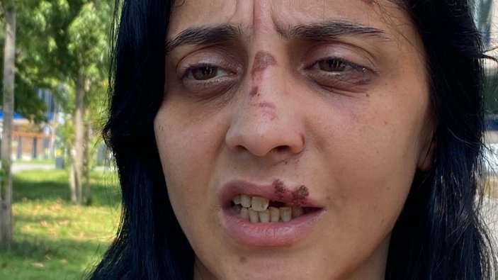Zonguldak'ta bir kadın, tanımadığı şahsın saldırısına uğradı