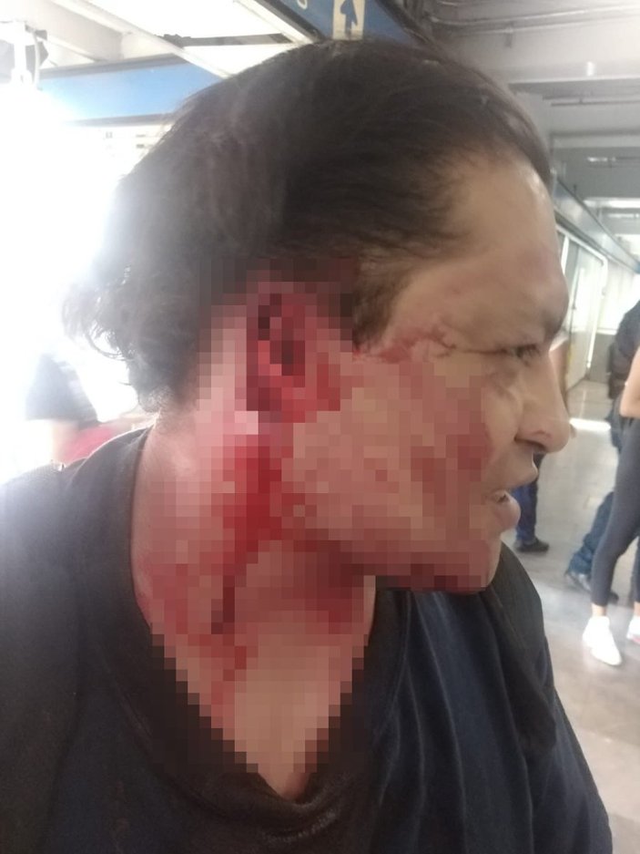 Meksika'da taciz ettiği iddia edilen kişinin kulağını koparttı