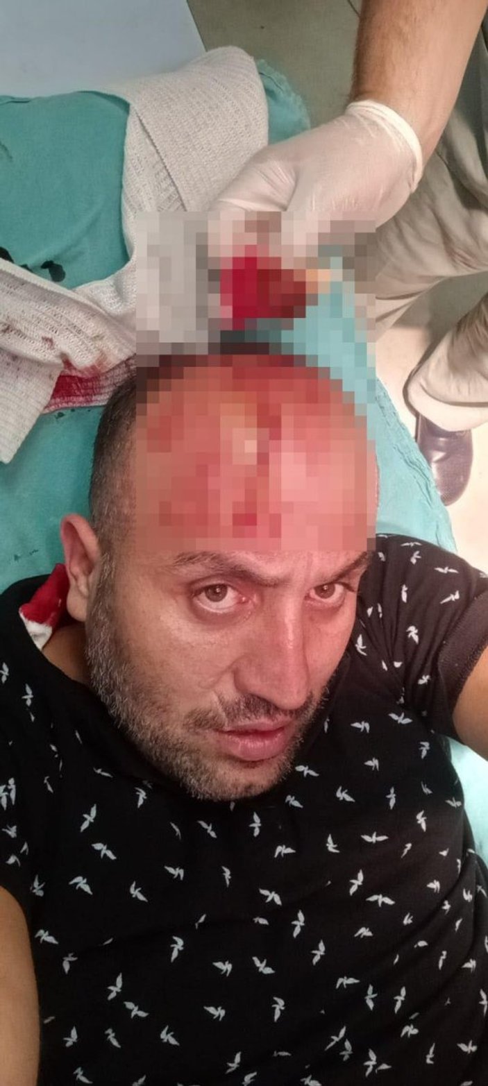 Zonguldak’ta sokak köpeklerini saldırısına uğrayan adam yaralandı