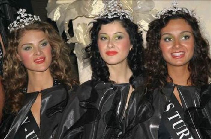 Sosyal medya Birce Akalay'ın estetiksiz halini konuşuyor! 'Gerçek olamaz'