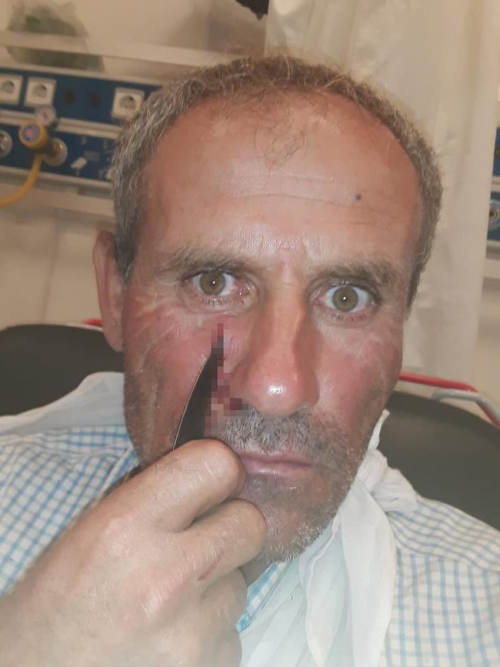 Denizli'de ayçiçeği tarlasında çalışan işçinin yüzüne bıçak saplandı