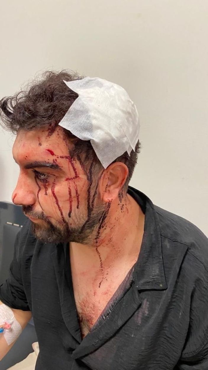 Üsküdar'da akrabaları tarafından asma kilitle darbedildi