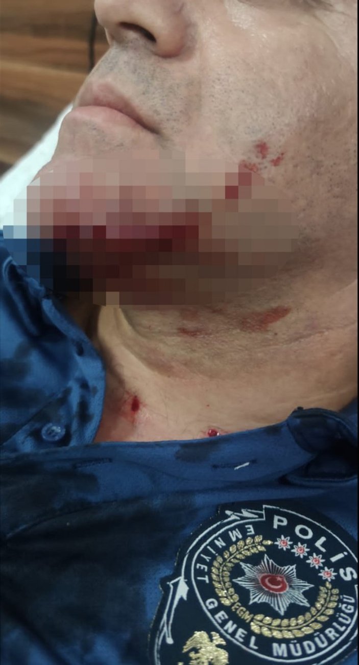 İzmir’de polisi yaraladı, serbest kaldı