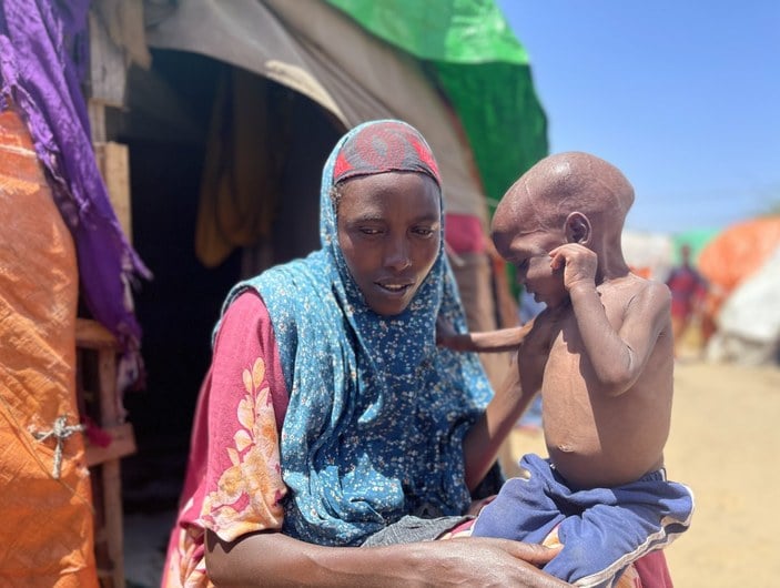 Somali'de milyonlarca insan açlık ve kuraklıkla mücadele ediyor