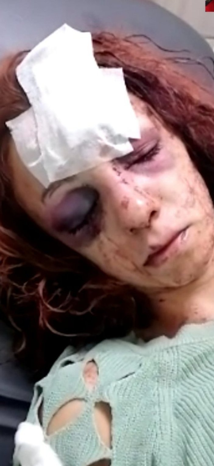 Mersin'de kıskançlık krizi: Genç kadını öldüresiye dövdü