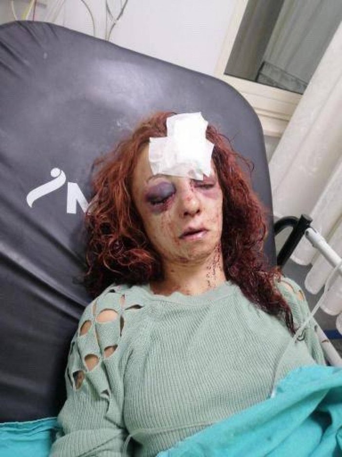 Mersin'de kıskançlık krizi: Genç kadını öldüresiye dövdü