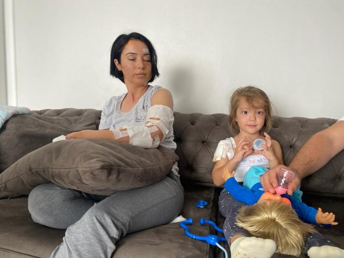 Samsun’da yasaklı ırk köpekler, anne ve 4 yaşındaki kızına saldırdı