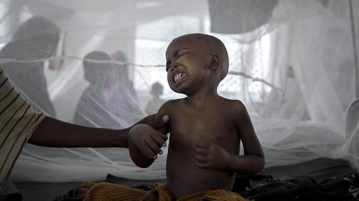 DSÖ: Suriye’de kolera vakaları 10 bini geçti