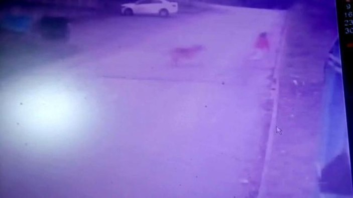 Sakarya'da başıboş köpekler, küçük çocuğa saldırdı