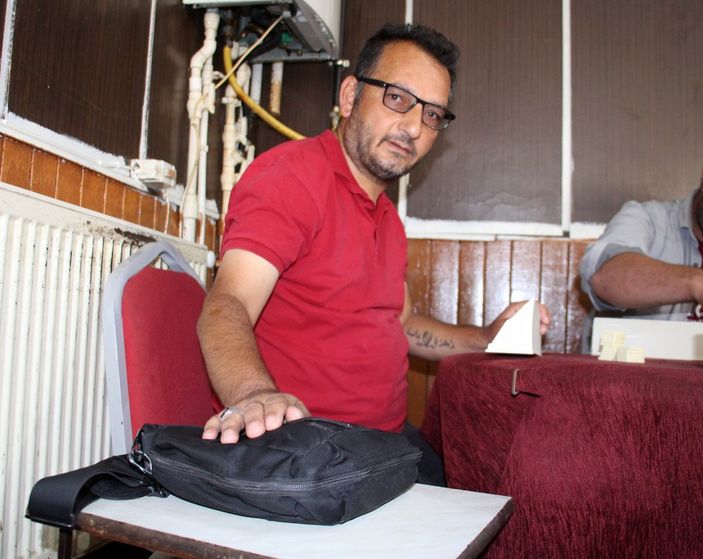 i Sivas'ta yapay kalple yaşayan adam: Çantamı para dolu zannediyorlar