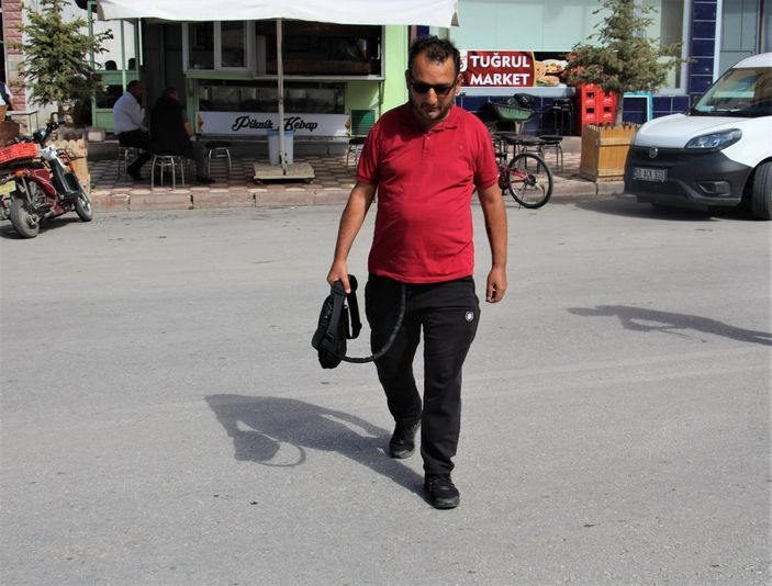 i Sivas'ta yapay kalple yaşayan adam: Çantamı para dolu zannediyorlar
